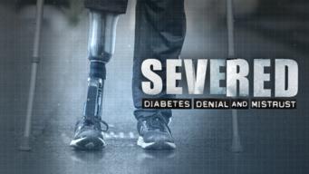 Severed: Diabetes Denial and Mistrust  (2024)